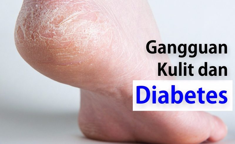 Gangguan Kulit dan Diabetes