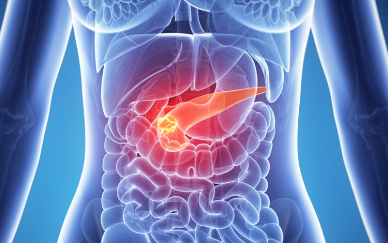 Diabetes tipe 2 dan Mekanisme dalam tubuh