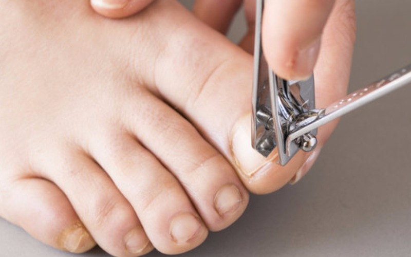 Tips Diabetes - Perawatan Kaki Diabetasi