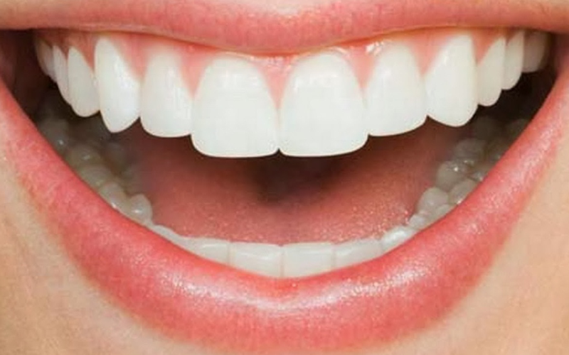 Komplikasi Diabetes Mellitus pada Gigi