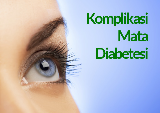 Obat Diabetes Melitus Dapat Menghindari Komplikasi Mata Serius