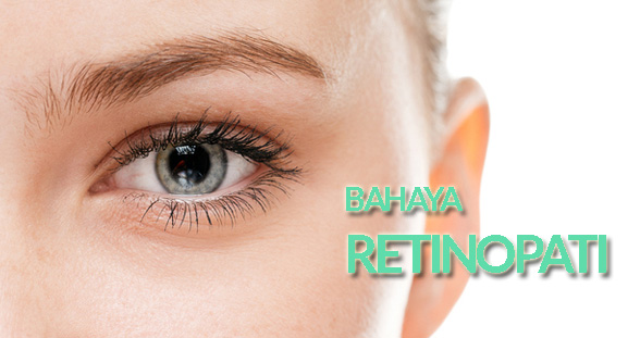 Retinopati Bisa Dicegah Dengan Obat Sakit Diabetes